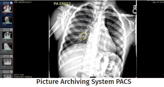 PACS Integration